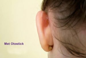 oren met oorcorrectie doormiddel van flapoorstickers